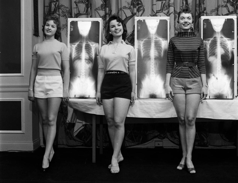 X-ray, plumb and weights: how to choose "Miss correct posture" in the 50s