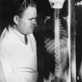 You can see right through the story: the first patients on X-ray