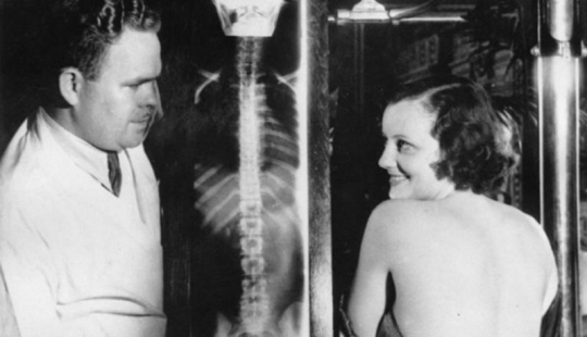 You can see right through the story: the first patients on X-ray