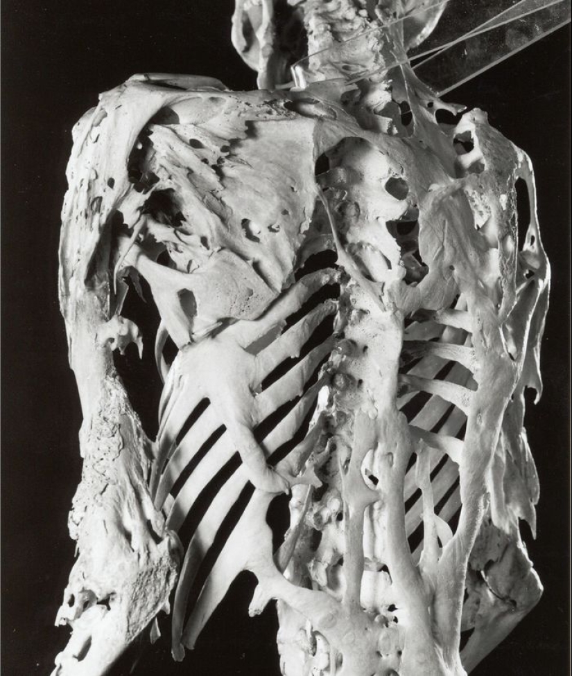 10 condiciones médicas extrañas que casi nadie ha oído hablar de 10 condiciones médicas extrañas que casi nadie ha oído hablar de