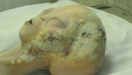 10 engaños científicos que conmocionaron al mundo 10 engaños científicos que conmocionaron al mundo