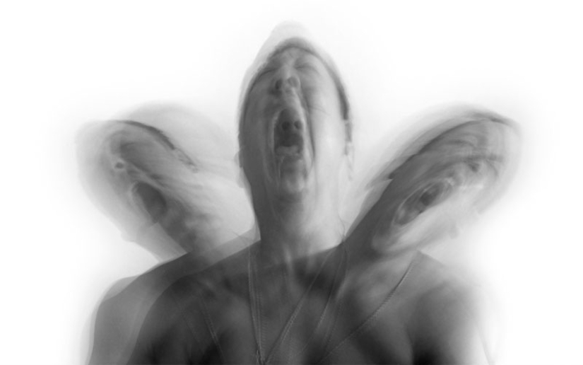 10 medicamentos con los efectos secundarios más extraños 10 medicamentos con los efectos secundarios más extraños