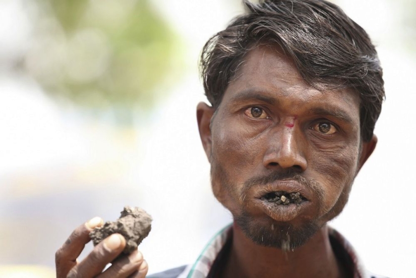 10 strange medical conditions that almost no one has heard of 10 strange medical conditions that almost no one has heard of