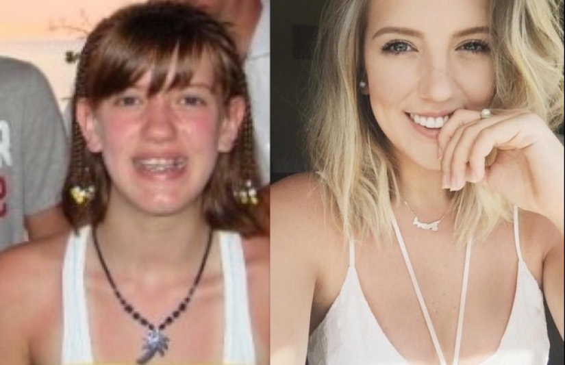16 amazing transformations of people: in adolescence and now