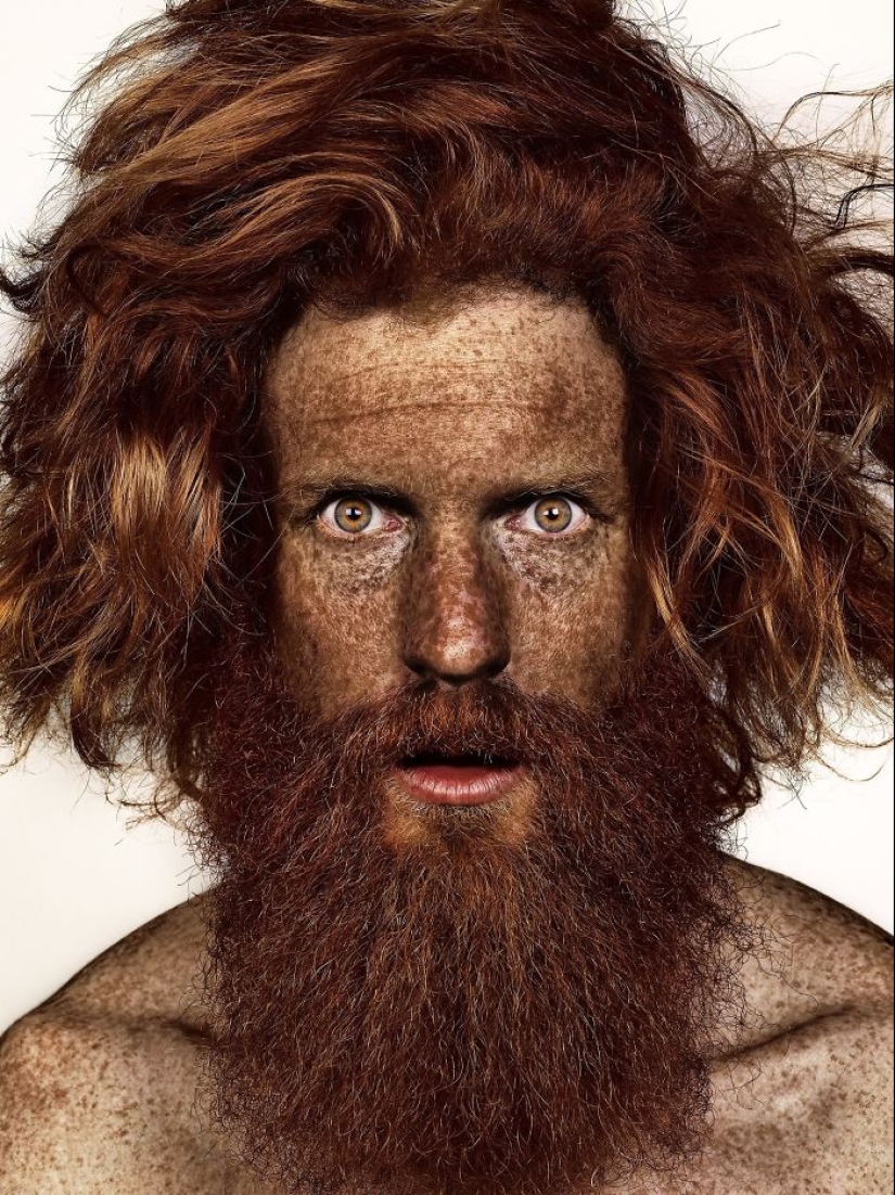 16 Mesmerizing Photos of People with Freckles 16 Mesmerizing Photos of People with Freckles