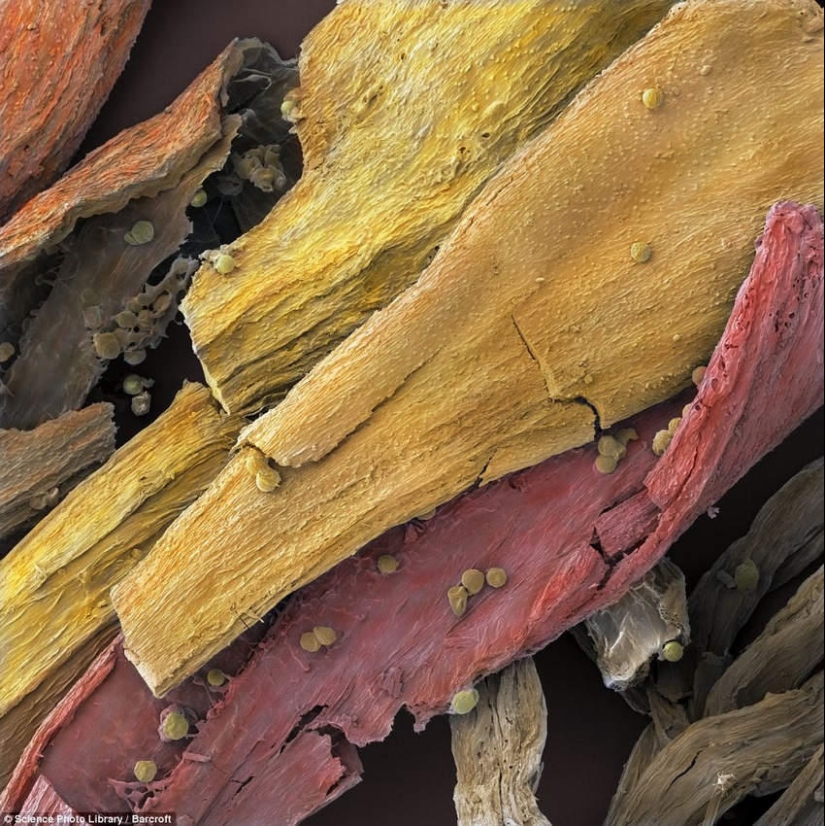 18 amazing photos of products under the microscope