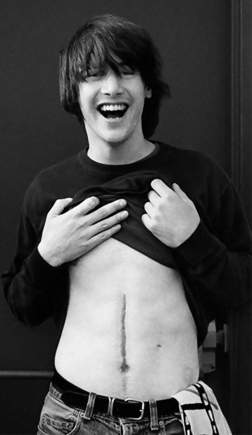 20 stories of the appearance of scars in Russian and foreign stars 20 stories of the appearance of scars in Russian and foreign stars