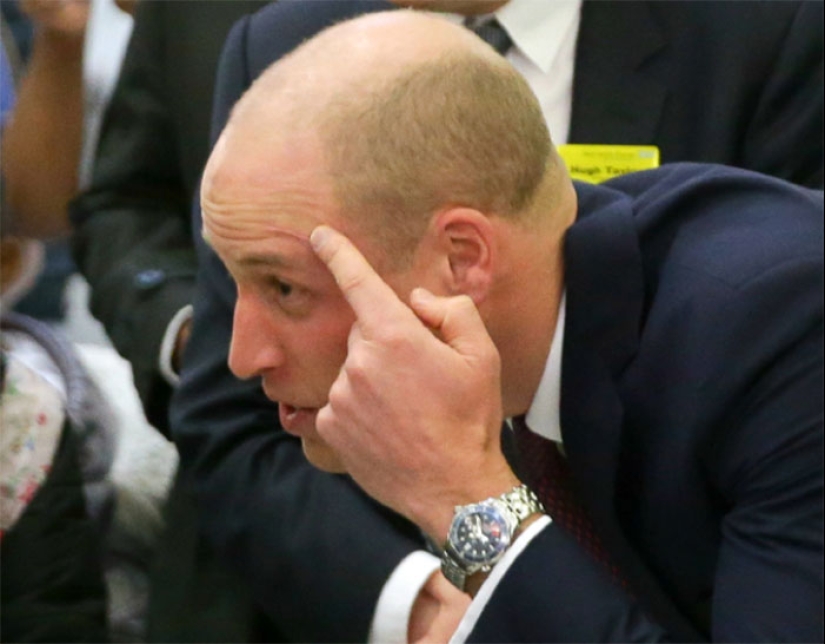 20 stories of the appearance of scars in Russian and foreign stars 20 stories of the appearance of scars in Russian and foreign stars