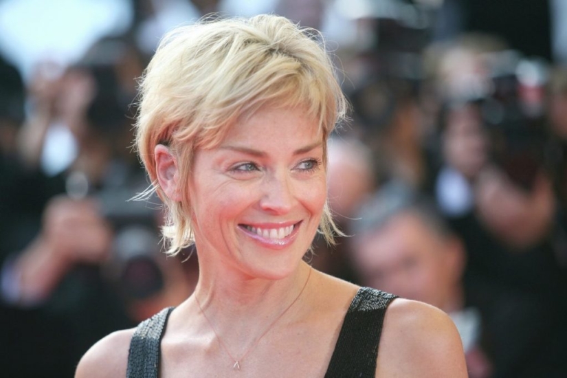 20 stories of the appearance of scars in Russian and foreign stars 20 stories of the appearance of scars in Russian and foreign stars