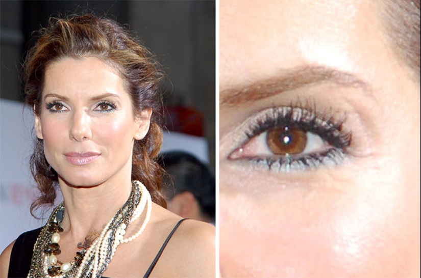 20 stories of the appearance of scars in Russian and foreign stars 20 stories of the appearance of scars in Russian and foreign stars