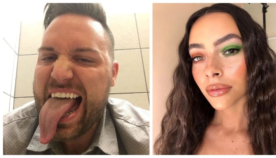 22 ejemplos en los que un mal funcionamiento de los genes dio a las personas un chip de apariencia único