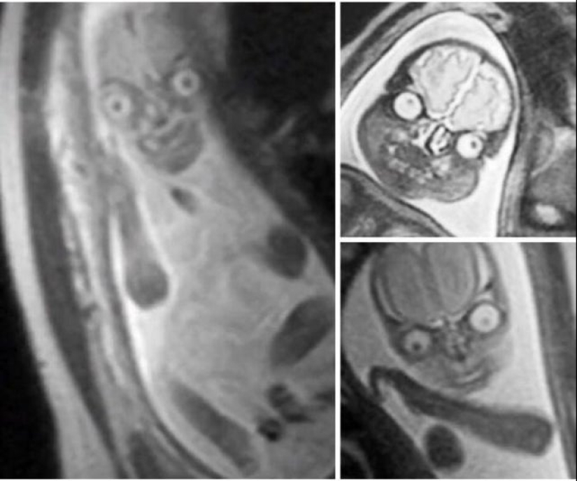 22 fotos de cosas muy extrañas y hasta aterradoras que realmente existen 22 fotos de cosas muy extrañas y hasta aterradoras que realmente existen