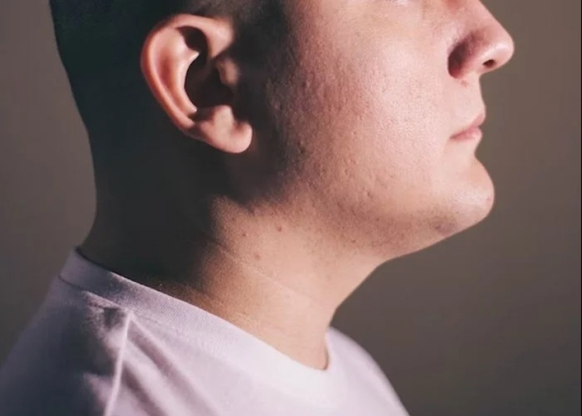 25 weird, creepy and creepy facts about the human body 25 weird, creepy and creepy facts about the human body