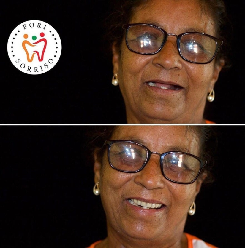 30 fotos antes y después de que la gente recuperara su sonrisa 30 fotos antes y después de que la gente recuperara su sonrisa