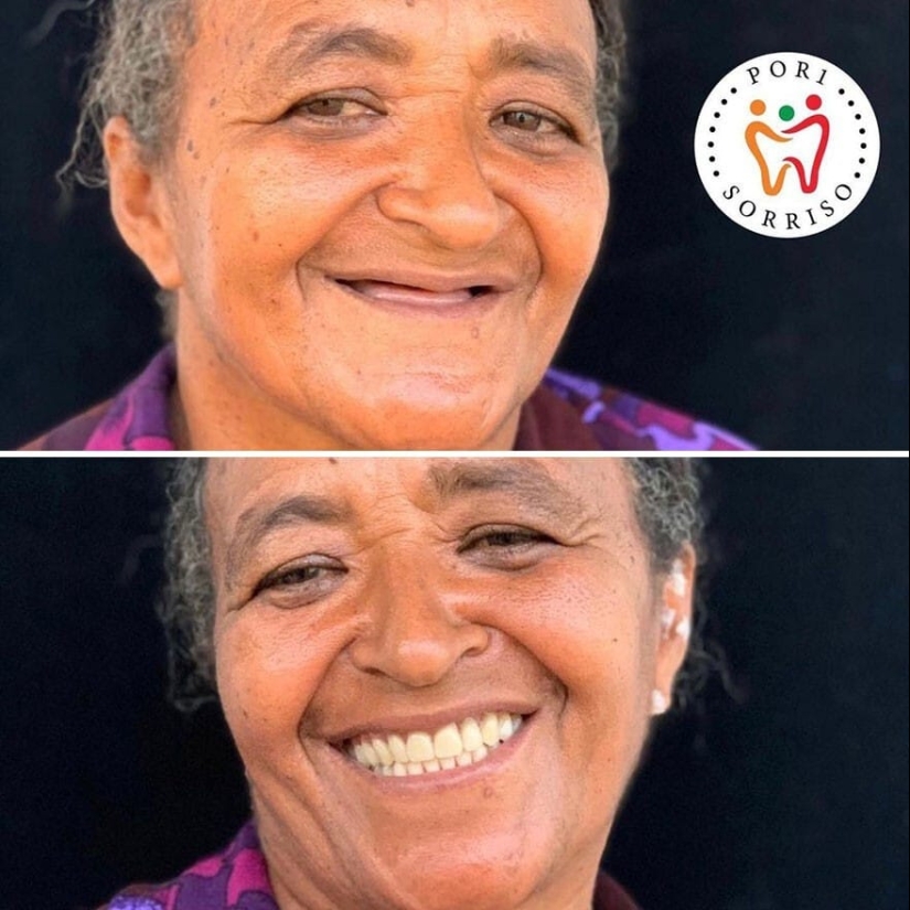 30 fotos antes y después de que la gente recuperara su sonrisa 30 fotos antes y después de que la gente recuperara su sonrisa