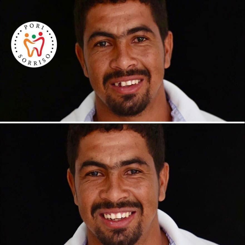 30 fotos antes y después de que la gente recuperara su sonrisa 30 fotos antes y después de que la gente recuperara su sonrisa