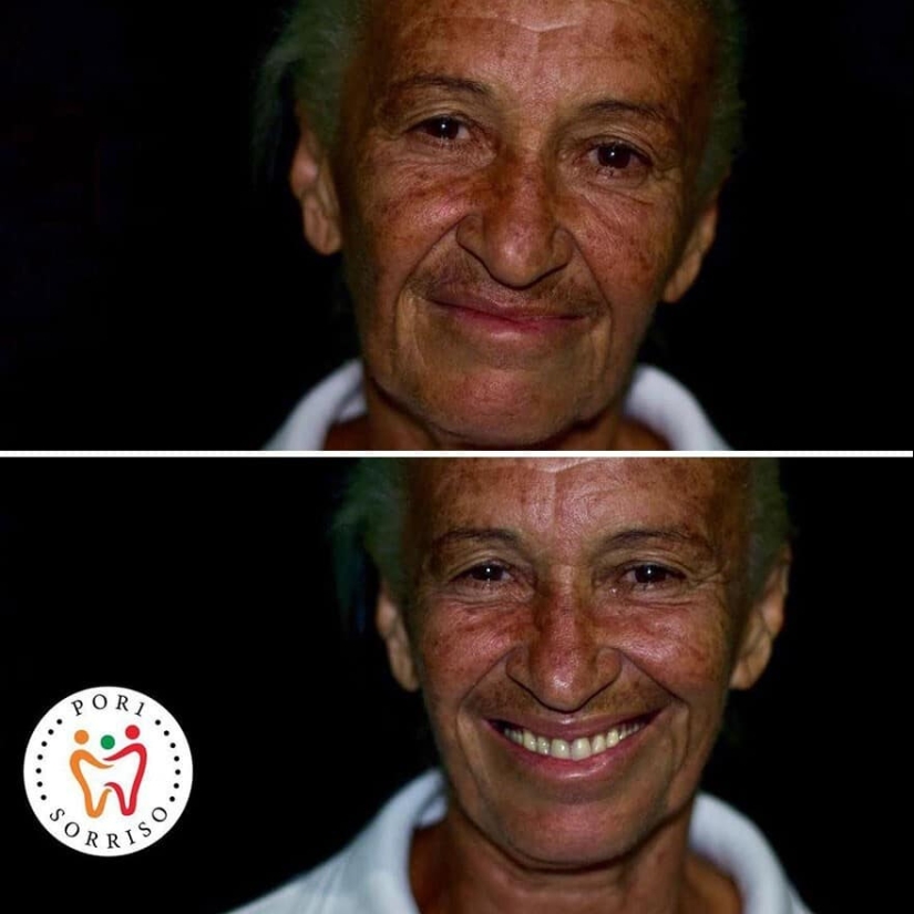 30 fotos antes y después de que la gente recuperara su sonrisa 30 fotos antes y después de que la gente recuperara su sonrisa
