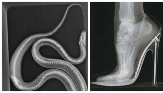 35 imágenes de rayos x que revelan el mundo de un inesperado trimestre 35 imágenes de rayos x que revelan el mundo de un inesperado trimestre