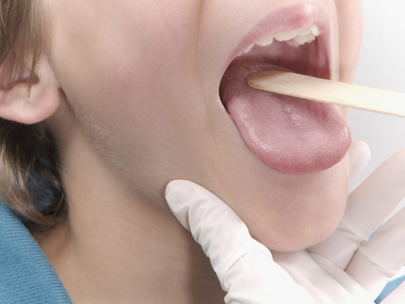 5 enfermedades inesperadas que se transmiten a través de un beso 5 enfermedades inesperadas que se transmiten a través de un beso