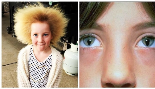 8 anomalies that demonstrate how unpredictable genetics