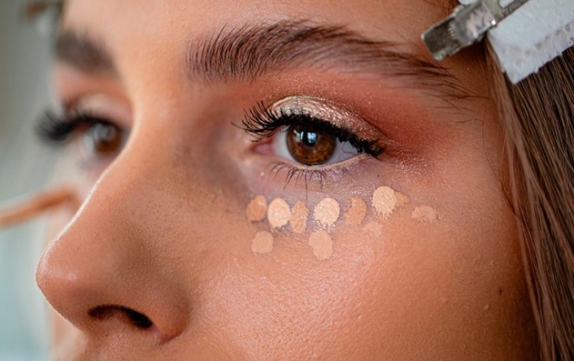 9 Proven Ways to Get Rid of bags under your Eyes