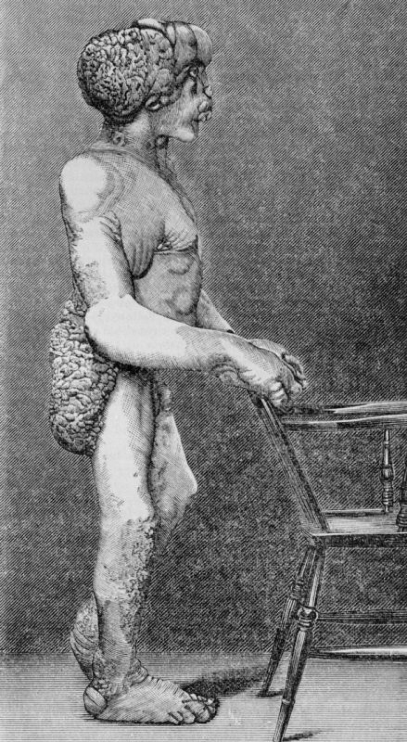 A Freak with a Beautiful Soul: The Story of Joseph Merrick-The Elephant Man A Freak with a Beautiful Soul: The Story of Joseph Merrick-The Elephant Man