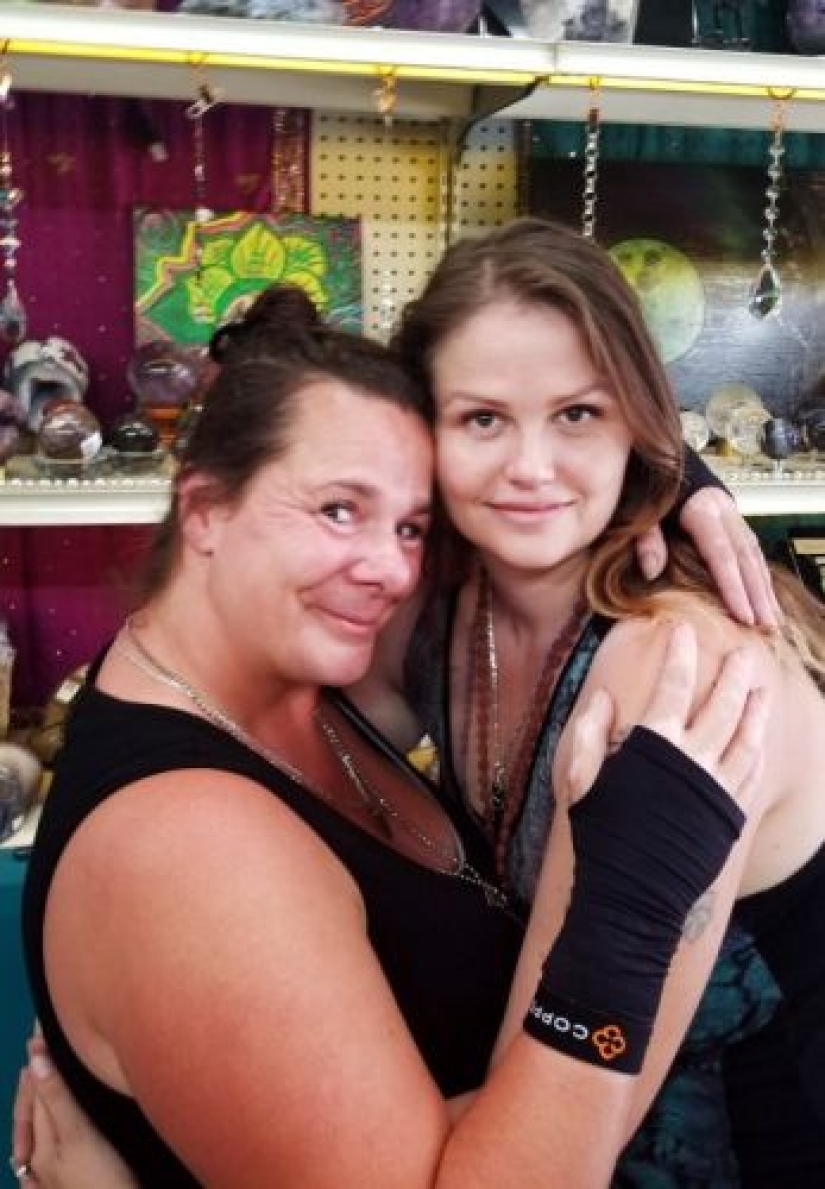 A hair scrunchie almost made a woman disabled A hair scrunchie almost made a woman disabled