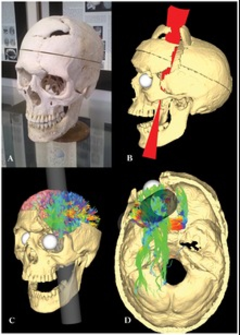 A real miracle: 10 of the most amazing cases of healing in medicine