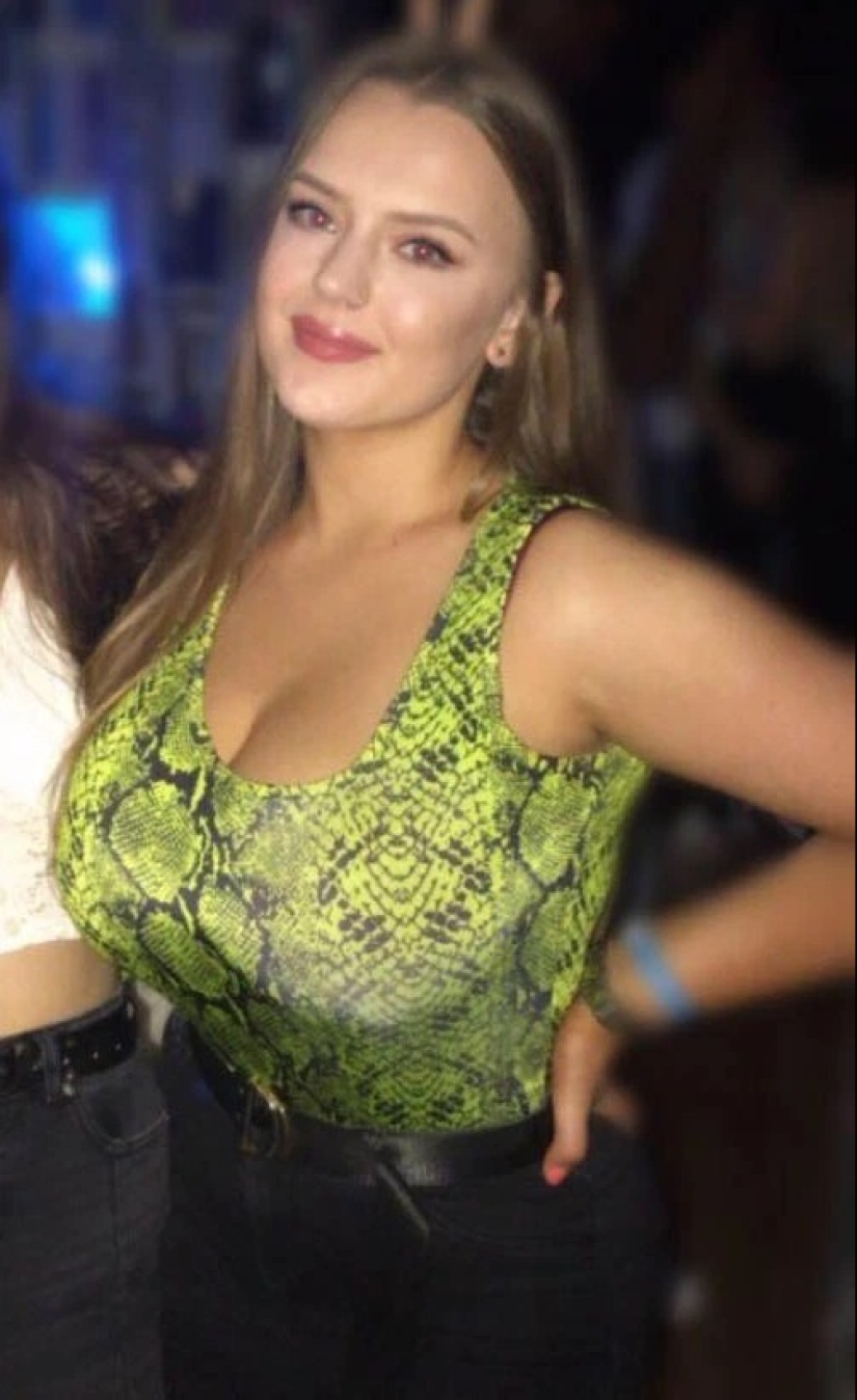 A stone on the heart: how women with large breasts suffer in everyday life