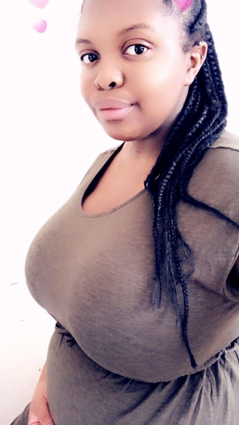 A stone on the heart: how women with large breasts suffer in everyday life