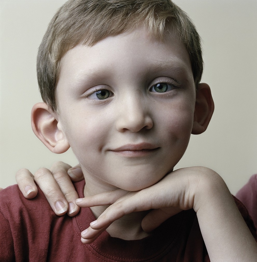 Acerca de la cara: retratos fotográficos de personas que sufren de parálisis Acerca de la cara: retratos fotográficos de personas que sufren de parálisis