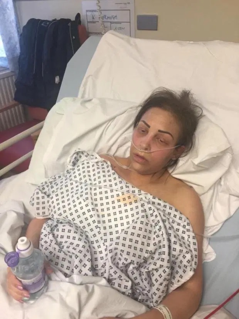 Airbag: historias de mujeres cuyos implantes mamarios salvaron sus vidas Airbag: historias de mujeres cuyos implantes mamarios salvaron sus vidas