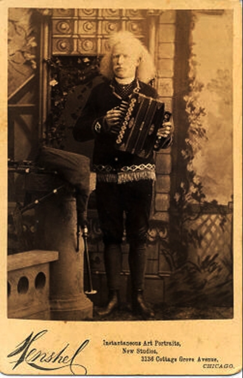 Albinos de circo del siglo XIX: personas con apariencias impactantes y destinos ficticios