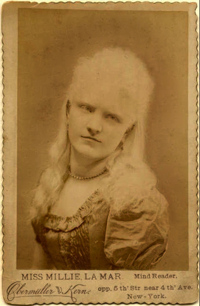 Albinos de circo del siglo XIX: personas con apariencias impactantes y destinos ficticios