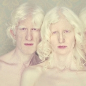 Albinos en la lente de Gustavo Lacerde