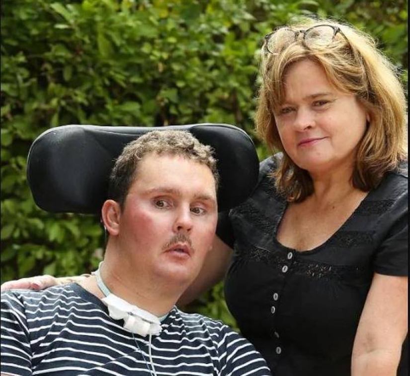 Ate a slug fell into a coma and died 8 years later: what led an innocent friendly debate Ate a slug fell into a coma and died 8 years later: what led an innocent friendly debate