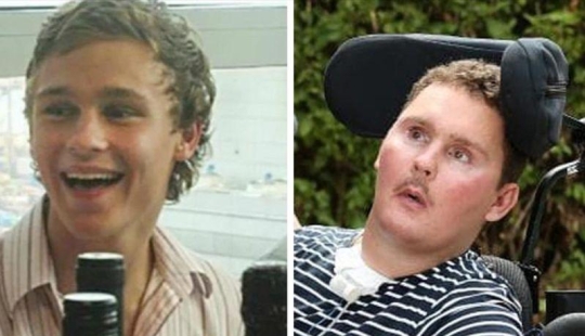 Ate a slug fell into a coma and died 8 years later: what led an innocent friendly debate