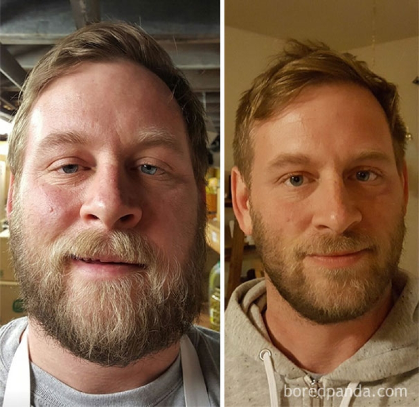 Before and after: how does the appearance of a person who stops drinking change