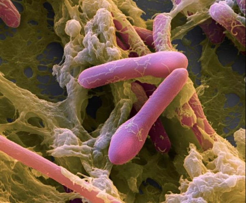 Casi una historia de detectives, o cómo la humanidad conoció el botulismo