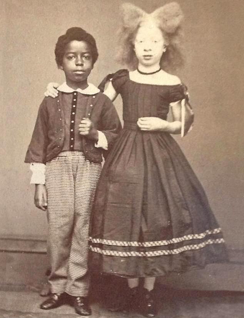 Circus albinos of the 19th century: people with shocking appearances and fictitious destinies