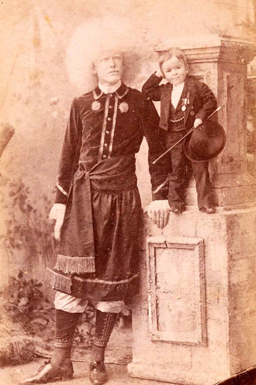 Circus albinos of the 19th century: people with shocking appearances and fictitious destinies
