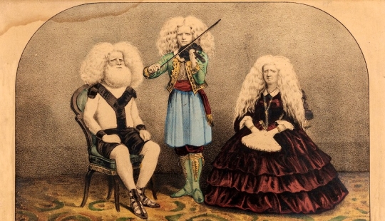 Circus albinos of the 19th century: people with shocking appearances and fictitious destinies Circus albinos of the 19th century: people with shocking appearances and fictitious destinies