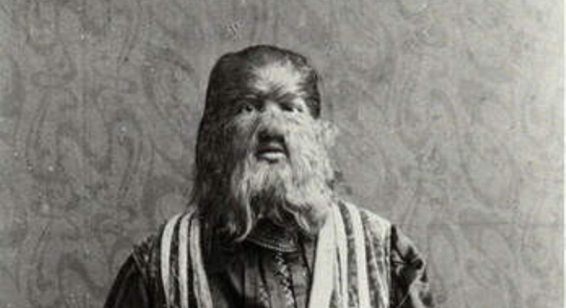 Cómo el “niño perro” ruso Fedya Evtikhiev se convirtió en una estrella de circo en Estados Unidos Cómo el “niño perro” ruso Fedya Evtikhiev se convirtió en una estrella de circo en Estados Unidos