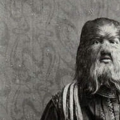 Cómo el “niño perro” ruso Fedya Evtikhiev se convirtió en una estrella de circo en Estados Unidos