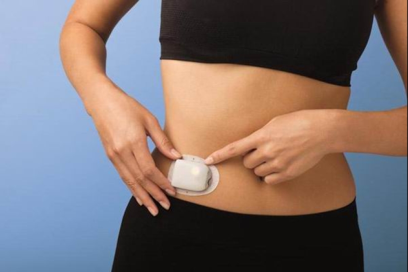 Cómo han cambiado las vidas de los diabéticos en los últimos 100 años