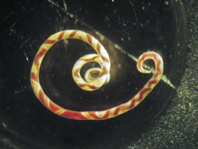 Comió un lingote cayó en coma y murió 8 años más tarde: ¿qué llevó a un inocente amistoso debate Comió un lingote cayó en coma y murió 8 años más tarde: ¿qué llevó a un inocente amistoso debate