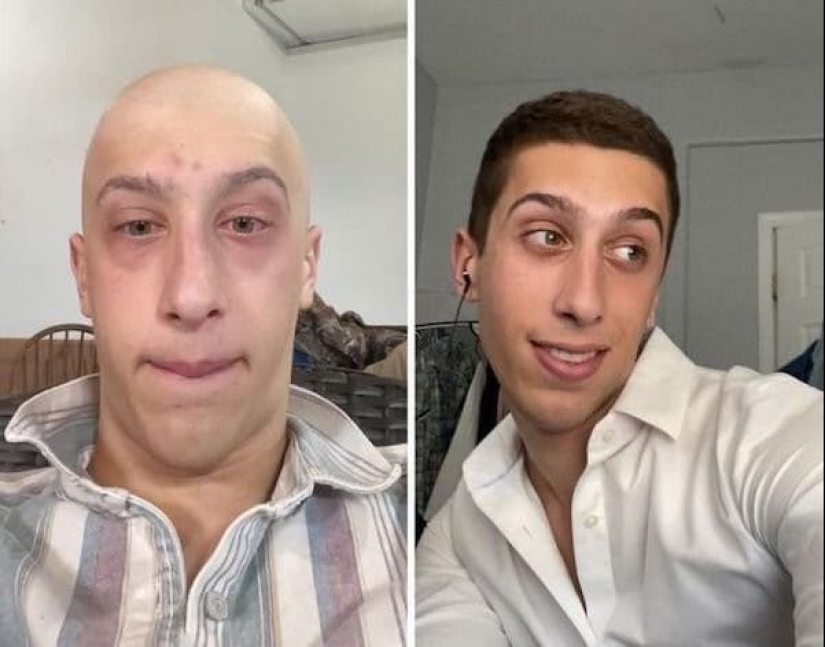 Con la voluntad de ganar! 22 fotos de antes y después que muestran cambios dramáticos Con la voluntad de ganar! 22 fotos de antes y después que muestran cambios dramáticos