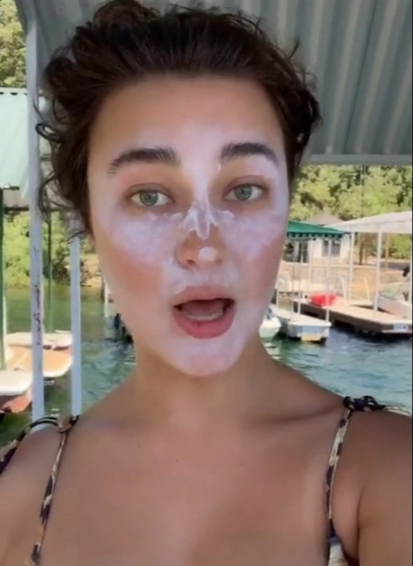 Consejos dañinos: trucos de la vida popular en la lucha contra las quemaduras solares que no deben repetirse Consejos dañinos: trucos de la vida popular en la lucha contra las quemaduras solares que no deben repetirse