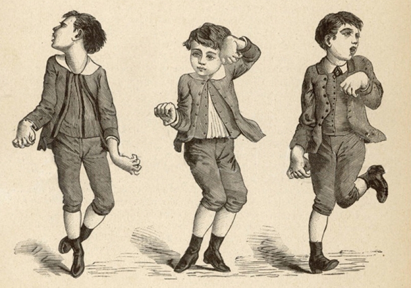 "Dancing plague" of the middle Ages — a deadly epidemic, the nature of which is still debated