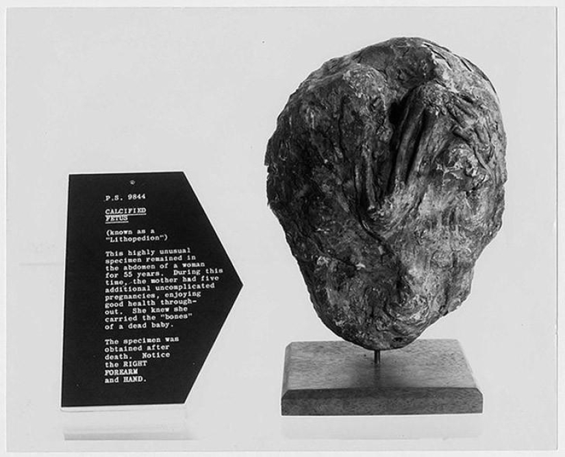 Datos interesantes sobre las momias más inusuales de la historia Datos interesantes sobre las momias más inusuales de la historia